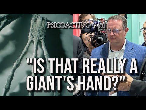 Congressman Receives Alleged Alien Hand in Mexico City